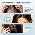 Bodywise® CRECIMIENTO DE CABELLO 50 ml en Roll-On + ENVÍO GRATIS 🎁