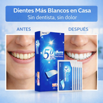 5D White Pro – Tiras Blanqueadoras