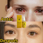 OFTALMIEL™🐝 Bienestar para tus ojos + ENVÍO GRATIS 🎁